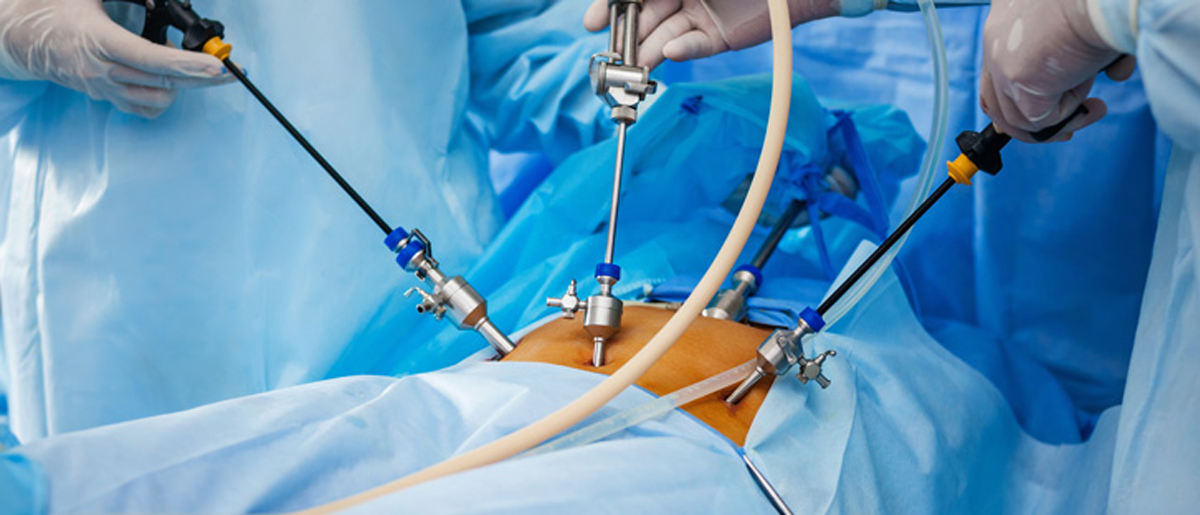 laparoscopic surgery
